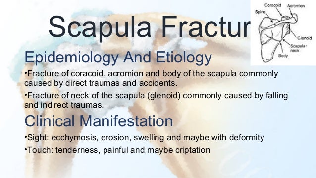 Image result for scapula fracture