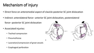 Fracture around Shoulder Girdle Dr.Kushal | PPTX