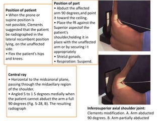 Clements Modification Shoulder girdle presentation | PPTX