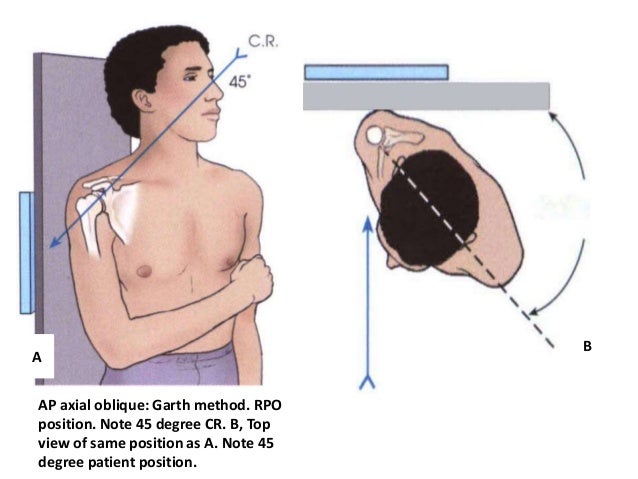 shoulder-girdle-presentation