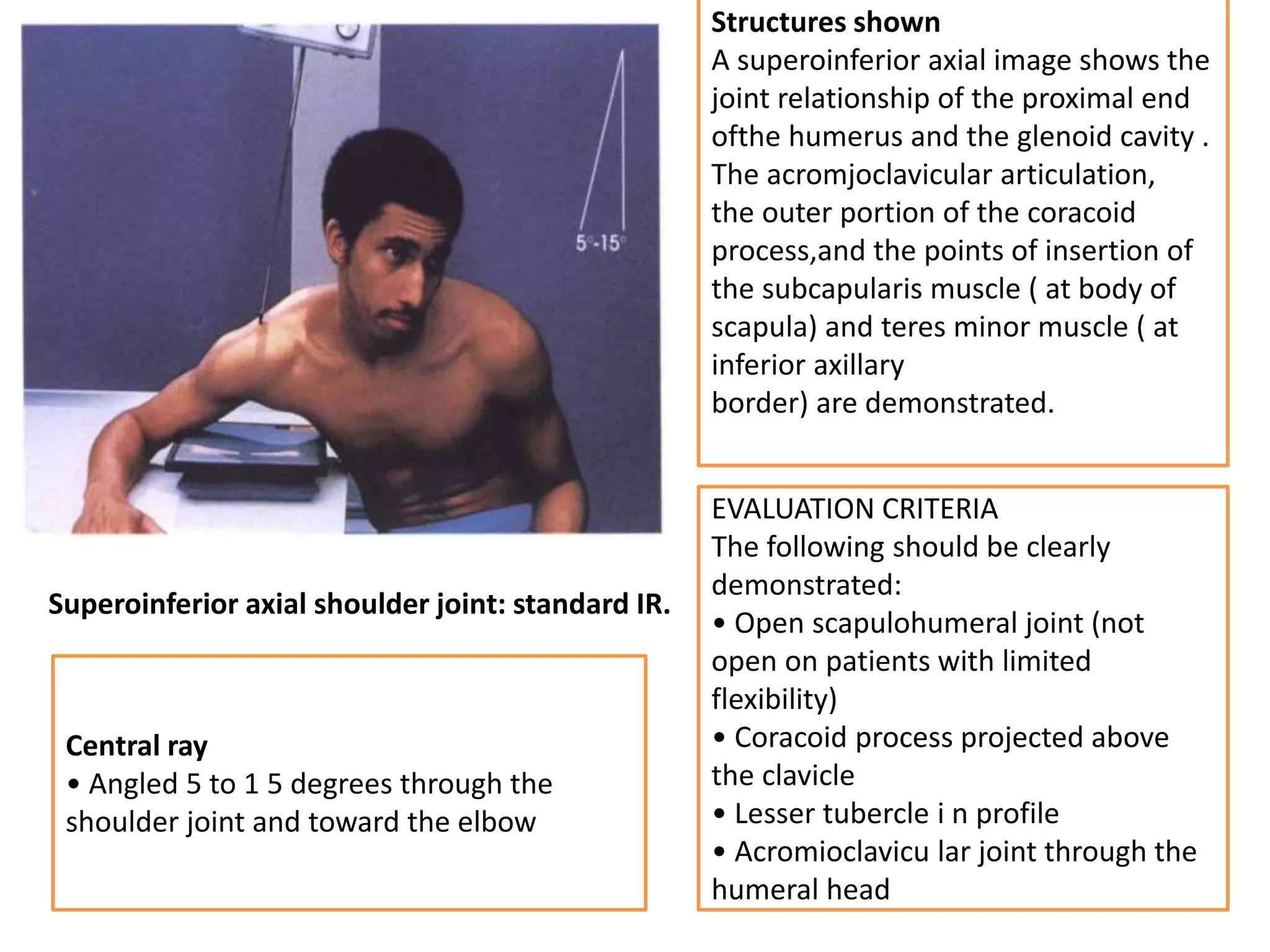 Shoulder girdle presentation | PPTX