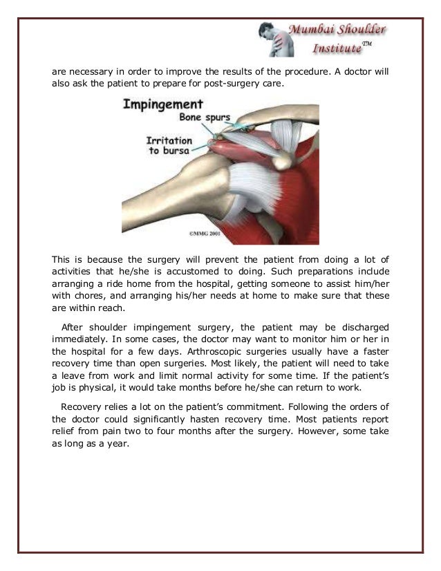 Important Facts about Shoulder Impingement Surgery.