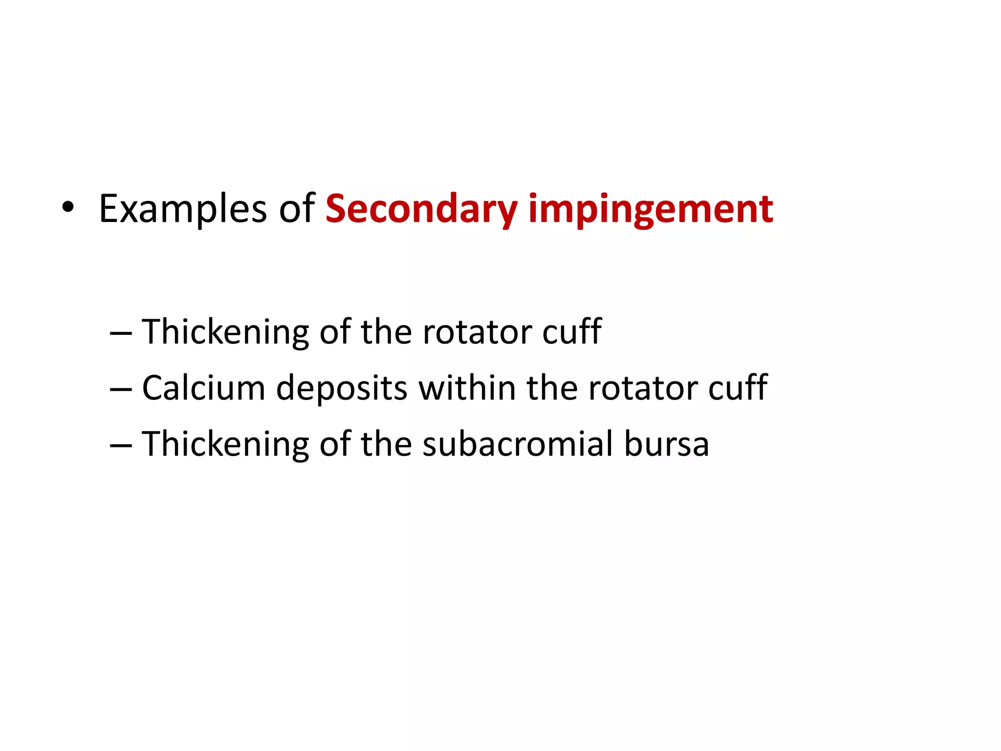 Shoulder impingement syndrome | PPTX
