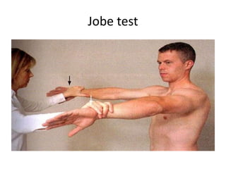 Jobe test
 