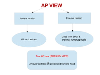 AP VIEW
Internal rotation External rotation
Hill sach lesions
Good view of GT &
proximal humerusphysis
Ture AP view (GRASHEY VIEW)
Articular cartilage of glenoid and humeral head
 