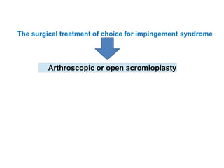 The surgical treatment of choice for impingement syndrome
Arthroscopic or open acromioplasty
 