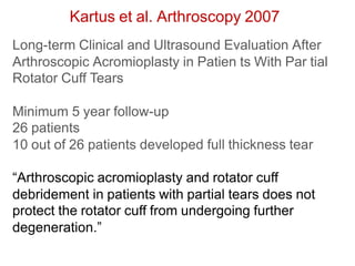 Kartus et al. Arthroscopy 2007
Long-term Clinical and Ultrasound Evaluation After
Arthroscopic Acromioplasty in Patien ts With Par tial
Rotator Cuff Tears
Minimum 5 year follow-up
26 patients
10 out of 26 patients developed full thickness tear
“Arthroscopic acromioplasty and rotator cuff
debridement in patients with partial tears does not
protect the rotator cuff from undergoing further
degeneration.”
 