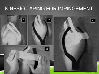 KINESIO-TAPING FOR IMPINGEMENT 
1 2 
3 
4 
RATAN KHUMAN (MPT ORTHO & SPORTS) 12/5/2014 22 
 