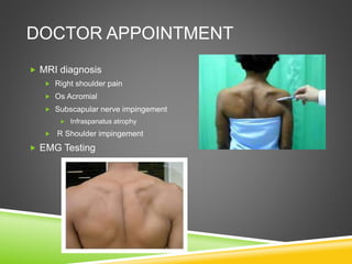 DOCTOR APPOINTMENT 
 MRI diagnosis 
 Right shoulder pain 
 Os Acromial 
 Subscapular nerve impingement 
 Infraspanatus atrophy 
 R Shoulder impingement 
 EMG Testing 
 