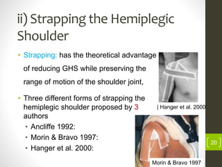 ii) Strapping the Hemiplegic
Shoulder
• Strapping: has the theoretical advantage
of reducing GHS while preserving the
range of motion of the shoulder joint,
• Three different forms of strapping the
hemiplegic shoulder proposed by 3
authors
• Ancliffe 1992:
• Morin & Bravo 1997:
• Hanger et al. 2000:
Morin & Bravo 1997
| Hanger et al. 2000
20
 