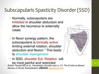 Subscapularis Spasticity Disorder (SSD)
• Normally, subscapularis are
inhibited in shoulder abduction and
allow the heumerus to externally
rotate
• In flexor synergy pattern, the
subscapularis is tonically active
limiting external rotation, shoulder
abduction and flexion 1 This leads
to shoulder impingement
• In SSD, shoulder Ext. Rotation will
be most painful and restricted
Robert Teasell MD et al., Hemiplegic shoulder pain p. 21; The Evidence-Based
Review of Stroke Rehabilitation (EBRSR) www.ebrsr.com
31
 