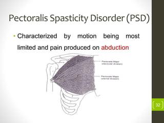 Pectoralis Spasticity Disorder (PSD)
• Characterized by motion being most
limited and pain produced on abduction
32
 