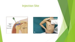Shoulder Injection | PPTX