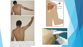 Shoulder Injection | PPTX