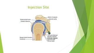 Shoulder Injection Note Shoulder Injection | PPTX