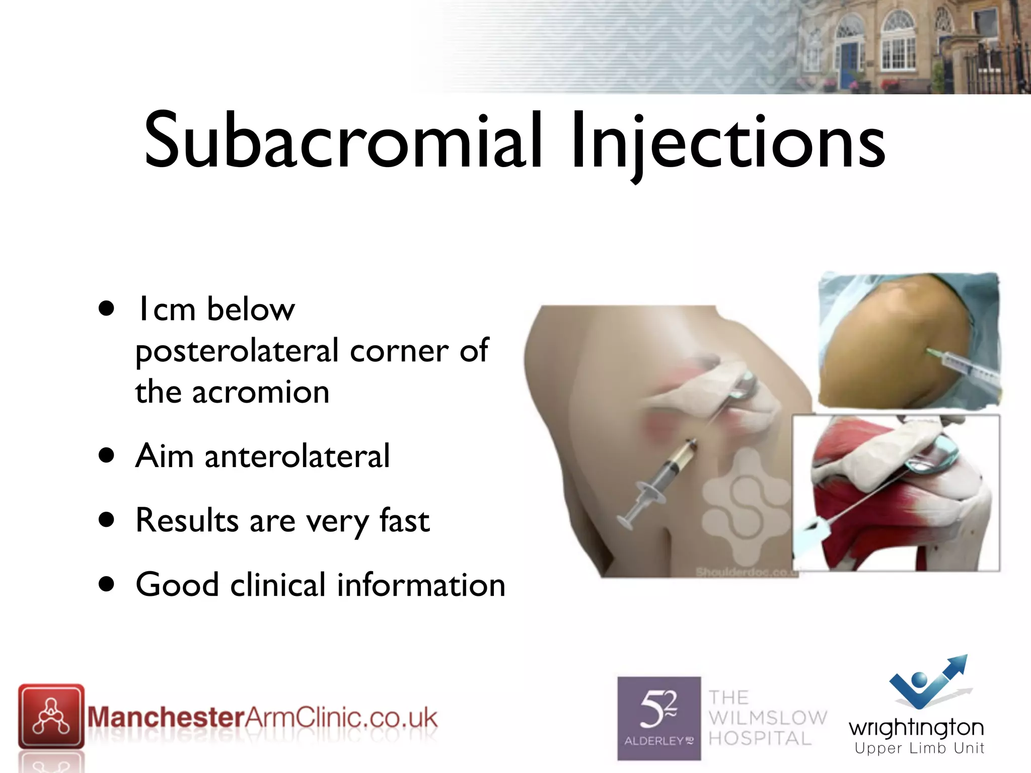 Shoulder injections mike walton | PDF