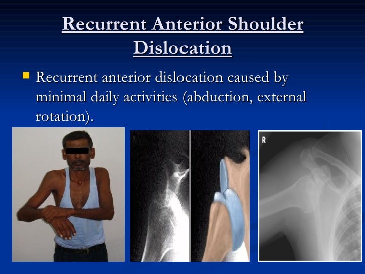 Orthopedics 5th year, 2nd lecture (Dr. Ariwan)