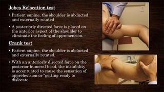 Internal Rotation Relocation Test Shoulder instability | PPTX