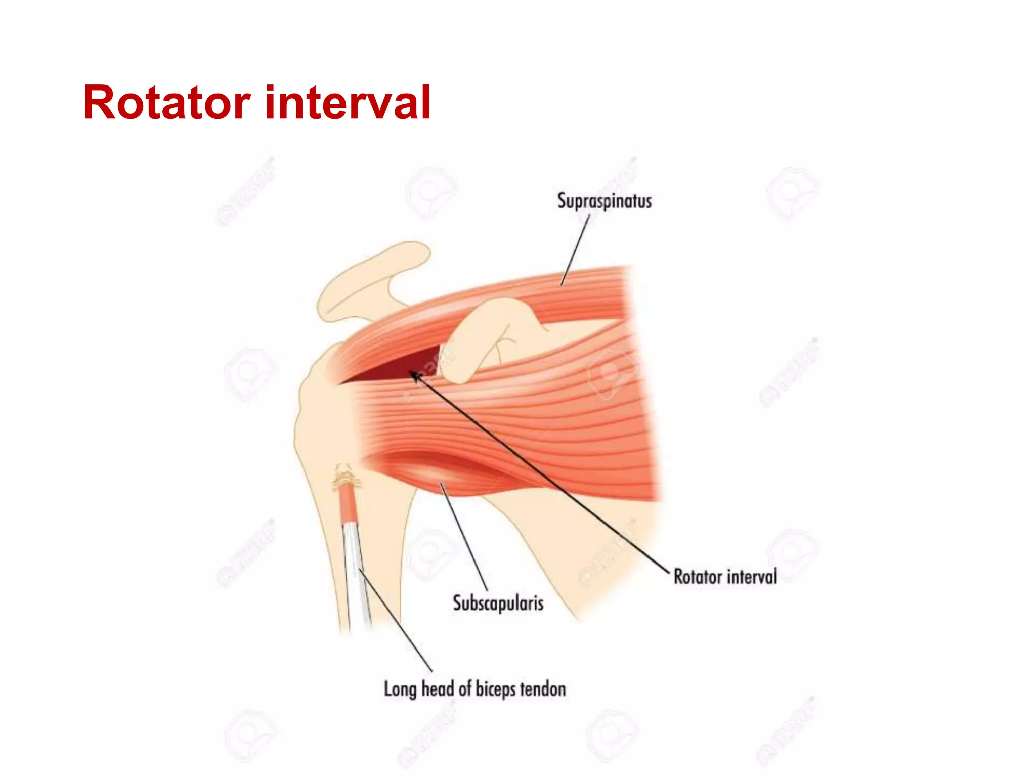 Rotator interval
 