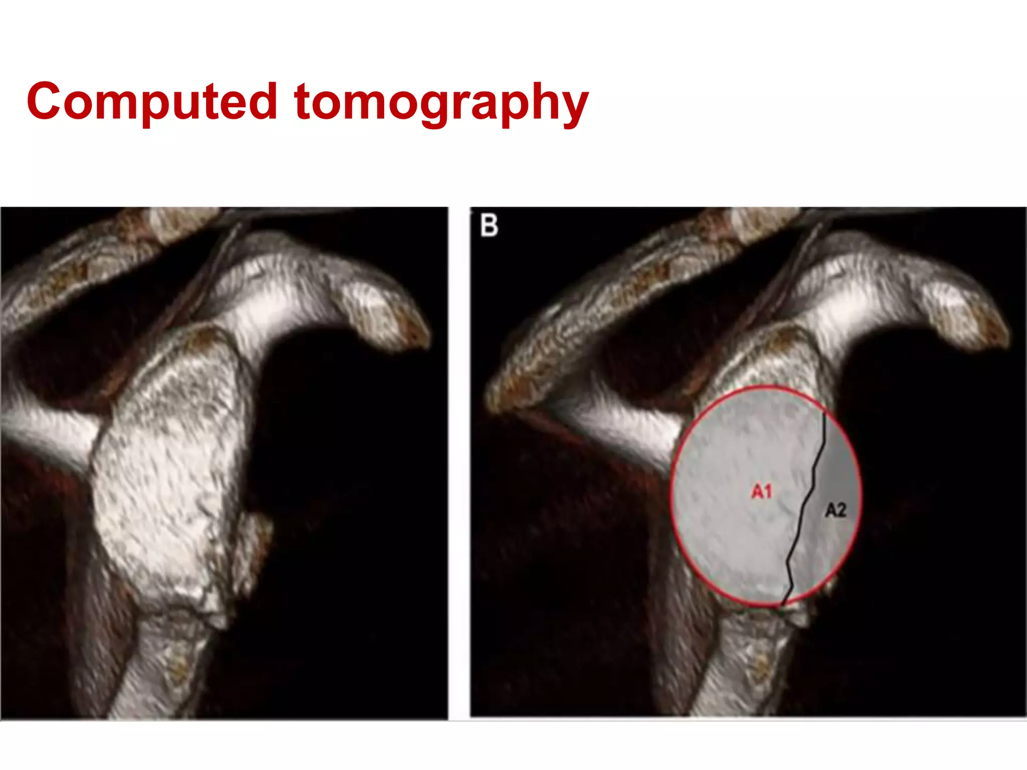 Computed tomography
 
