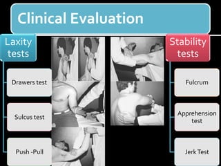 Clinical Evaluation
Laxity
tests
Drawers test
Sulcus test
Push -Pull
Stability
tests
Fulcrum
Apprehension
test
JerkTest
 