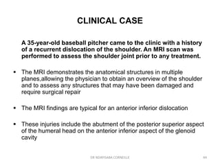 Shoulder joint | PPT