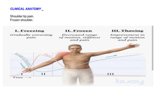 CLINICAL ANATOMY _
Shoulder tip pain.
Frozen shoulder.
 