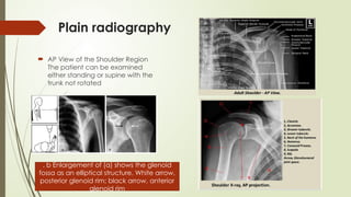 Comprehensive Anatomy and Imaging of the Shoulder Joint and Humerus | PPTX
