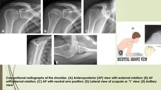 Comprehensive Anatomy and Imaging of the Shoulder Joint and Humerus | PPTX