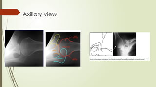 Comprehensive Anatomy and Imaging of the Shoulder Joint and Humerus | PPTX