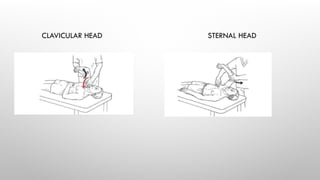 CLAVICULAR HEAD STERNAL HEAD
 