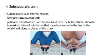 Comprehensive Shoulder Joint Examination and Pathology Assessment | PPTX