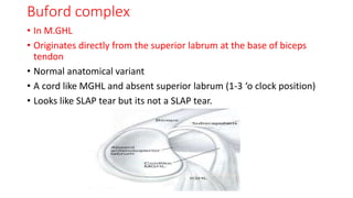Buford complex
• In M.GHL
• Originates directly from the superior labrum at the base of biceps
tendon
• Normal anatomical variant
• A cord like MGHL and absent superior labrum (1-3 ‘o clock position)
• Looks like SLAP tear but its not a SLAP tear.
 