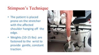 Stimpson’s Technique
• The patient is placed
prone on the stretcher
with the affected
shoulder hanging off the
edge.
• Weights (10-15 lbs) are
fastened to the wrist to
provide gentle, constant
traction.
 