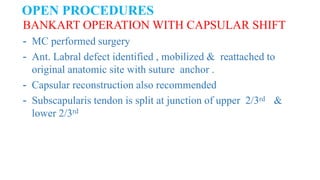 OPEN PROCEDURES
BANKART OPERATION WITH CAPSULAR SHIFT
- MC performed surgery
- Ant. Labral defect identified , mobilized & reattached to
original anatomic site with suture anchor .
- Capsular reconstruction also recommended
- Subscapularis tendon is split at junction of upper 2/3rd &
lower 2/3rd
 