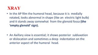 XRAY
• In the AP ﬁlm the humeral head, because it is medially
rotated, looks abnormal in shape (like an electric light bulb)
and it stands away somewhat from the glenoid fossa (the
‘empty glenoid’ sign).
• An Axillary view is essential; it shows posterior subluxation
or dislocation and sometimes a deep indentation on the
anterior aspect of the humeral head.
 