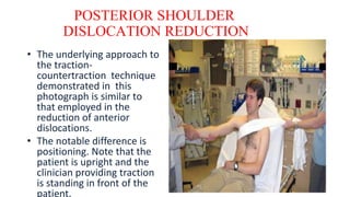 POSTERIOR SHOULDER
DISLOCATION REDUCTION
• The underlying approach to
the traction-
countertraction technique
demonstrated in this
photograph is similar to
that employed in the
reduction of anterior
dislocations.
• The notable difference is
positioning. Note that the
patient is upright and the
clinician providing traction
is standing in front of the
patient.
 