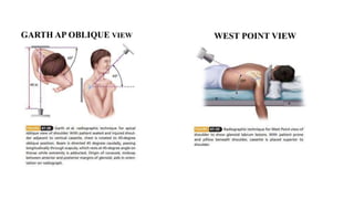 GARTH AP OBLIQUE VIEW WEST POINT VIEW
 