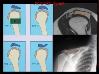 Shoulder joint xray & usg by Dr Soumitra Halder | PPT