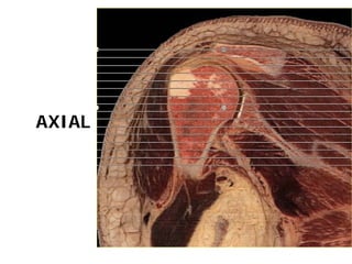 AXIAL
 