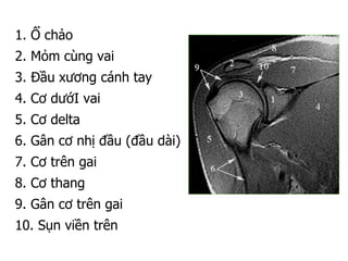 1. Ổ chảo
2. Mỏm cùng vai
3. Đầu xương cánh tay
4. Cơ dướI vai
5. Cơ delta
6. Gân cơ nhị đầu (đầu dài)
7. Cơ trên gai
8. Cơ thang
9. Gân cơ trên gai
10. Sụn viền trên
 