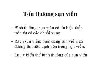 Toån thöông suïn vieàn
- Bình thöôøng, suïn vieàn coù tín hiệu thấp
treân tất cả caùc chuỗi xung.
- Raùch suïn vieàn: bieán daïng suïn vieàn, coù
ñöôøng tín hieäu dòch beân trong suïn vieàn.
- Löu yù bieán theå bình thöôøng cuûa suïn vieàn.
 