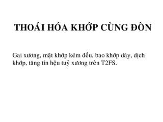 THOAÙI HOÙA KHÔÙP CUØNG ÑOØN
Gai xöông, maët khôùp keùm ñeàu, bao khôùp daøy, dòch
khôùp, taêng tín heäu tuyû xöông treân T2FS.
 