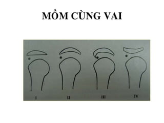 MOÛM CUØNG VAI
 