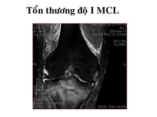 Toån thöông ñoä I MCL
 