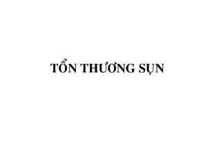 TOÅN THÖÔNG SUÏN
 