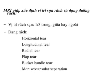 MRI giuùp xaùc ñònh vò trí suïn raùch vaø daïng ñöôøng
raùch:
- Vò trí raùch suïn: 1/3 trong, giöõa hay ngoaøi
- Daïng raùch:
o Horizontal tear
o Longitudinal tear
o Radial tear
o Flap tear
o Bucket handle tear
o Meniscocapsular separation
 