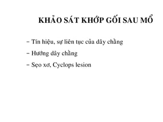 KHAÛO SAÙT KHÔÙP GOÁI SAU MOÅ
- Tín hieäu, söï lieân tuïc cuûa daây chaèng
- Höôùng daây chaèng
- Seïo xô, Cyclops lesion
 