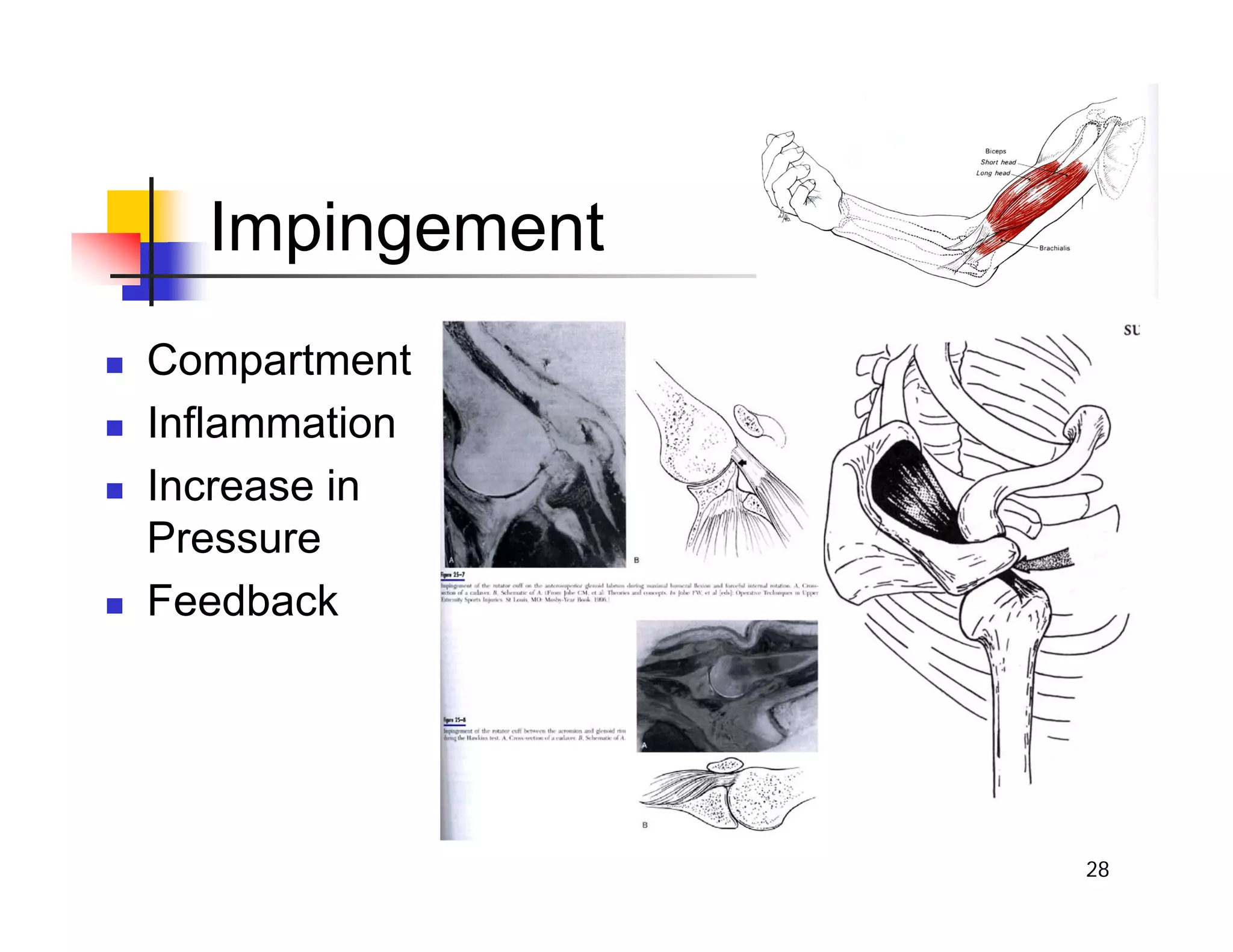 28
Impingement
„ Compartment
„ Inflammation
„ Increase in
Pressure
„ Feedback
 