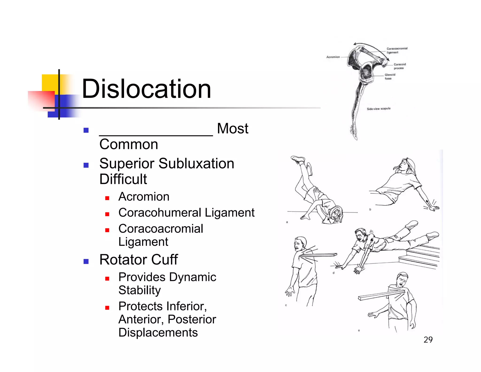 29
Dislocation
„ ______________ Most
Common
„ Superior Subluxation
Difficult
„ Acromion
„ Coracohumeral Ligament
„ Coracoacromial
Ligament
„ Rotator Cuff
„ Provides Dynamic
Stability
„ Protects Inferior,
Anterior, Posterior
Displacements
 